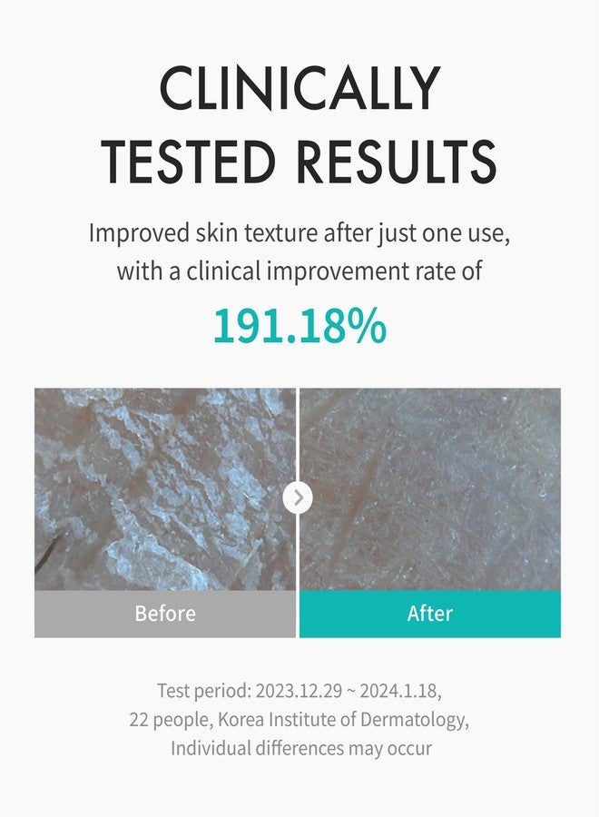 ريچوران تونر ريجوران® لعلاج الترطيب، سي-بي دي آر إن® - تونر مرطب للوجه لتعزيز قوة حاجز البشرة، وتهدئتها، والحفاظ على ترطيبها مع بي دي آر إكس، للعناية بالبشرة الكورية (5.07 أونصة سائلة) - Image 3